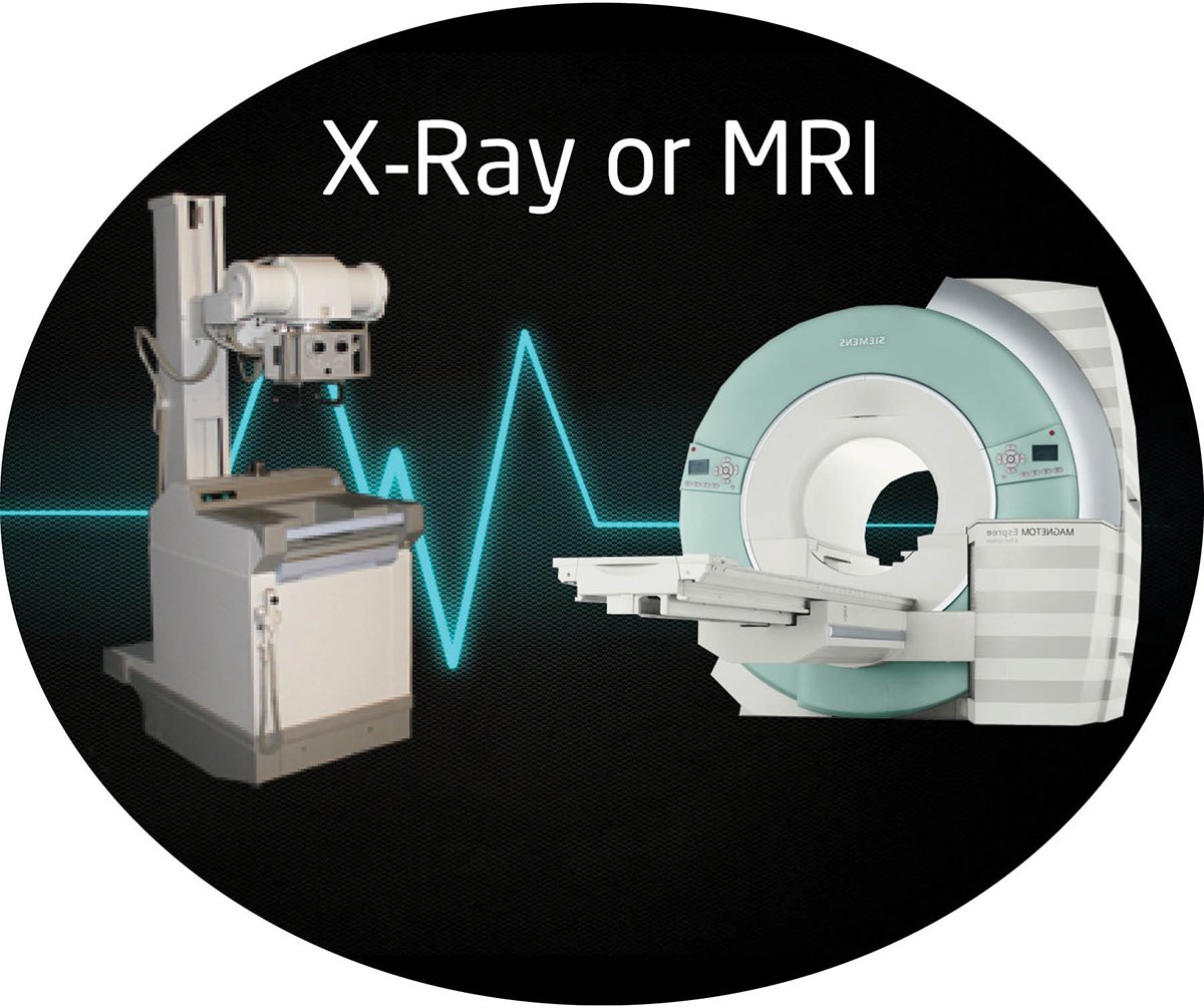 MRI or XRay?